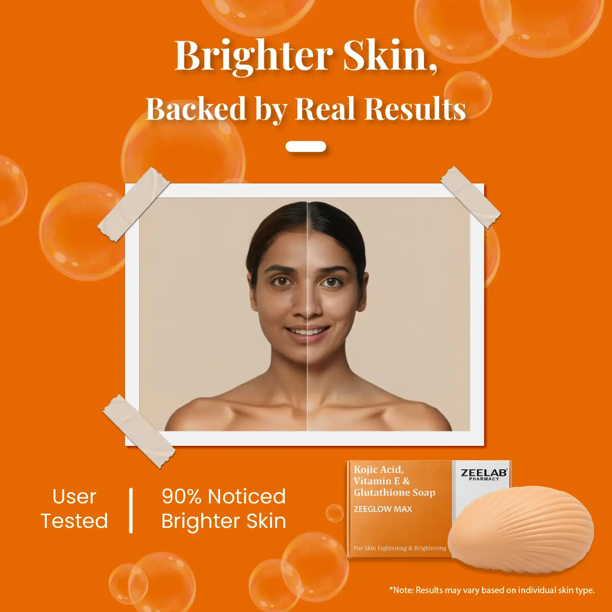 Zeeglow Max Kojic Acid and Glutathione Soap​ with Vitamin E 